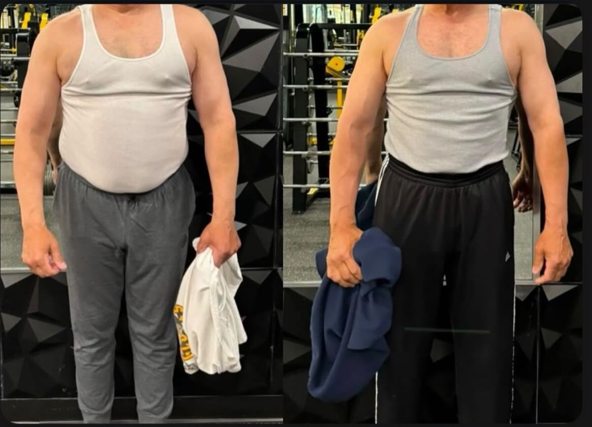 Client before and after — major waist reduction and flatter midsection