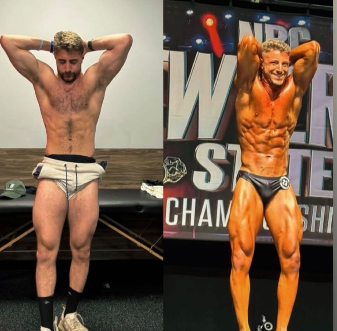 Client before and after — competition-ready stage-lean bodybuilding physique