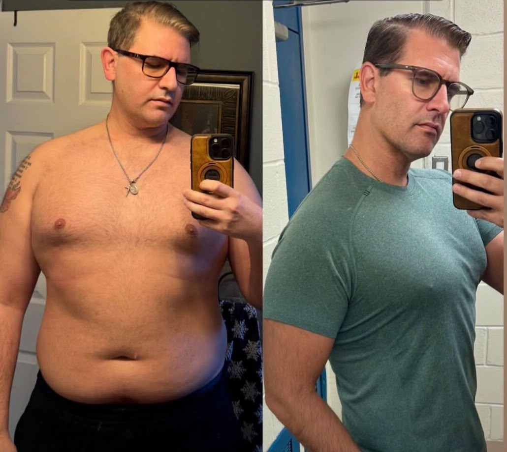 Client before and after — significant fat loss and slimmer torso